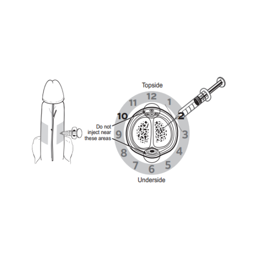 penile_injection_therapy penile_injection_therapy